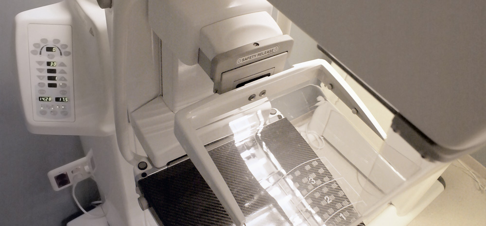 Maquina Mamografia CEDIV, Granollers